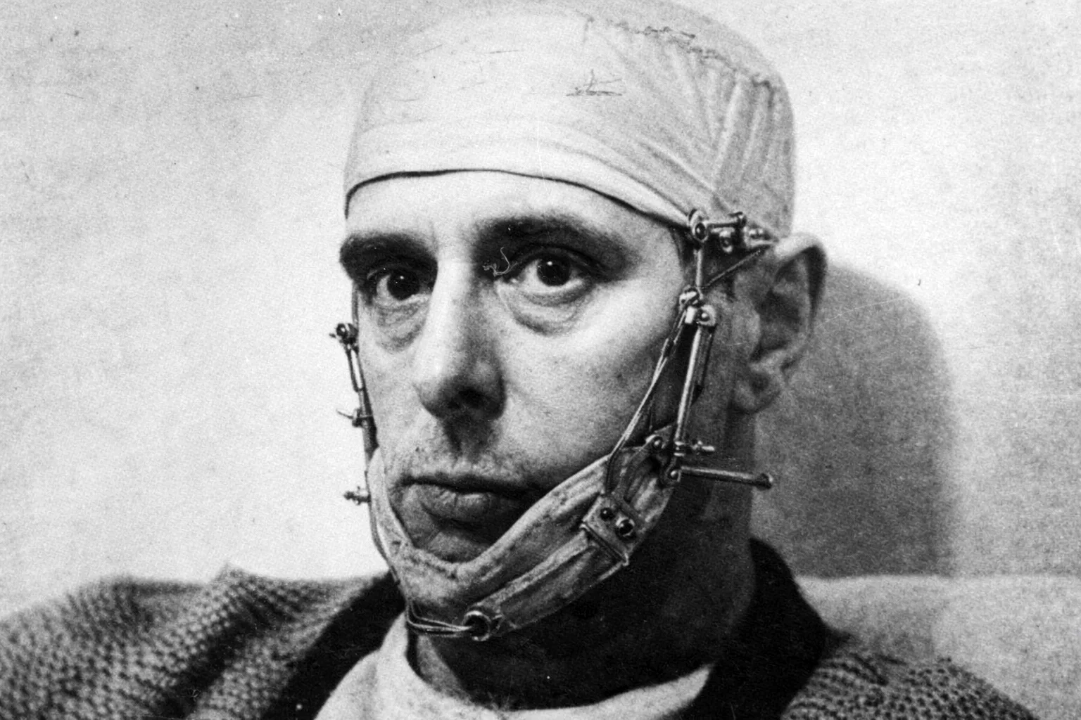 Hans Rauter na de aanslag